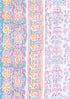 Cambric Cotton Dress Material With Kota Dupatta in Block Print